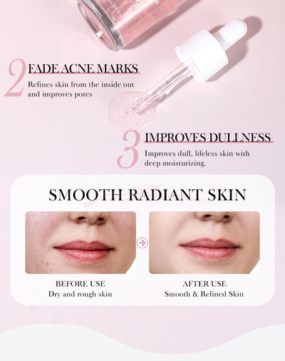 Anua Wonder Peach 70% Niacinamide Serum brightening hydrating face serum hyperpigmentation treatment reducing melanine daily clean beauty, 30ml SKU: WB-UA1652